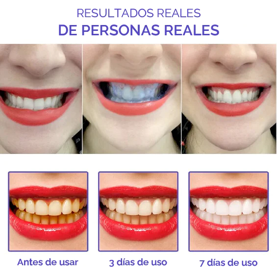 Smile kit - Dentes blancos T