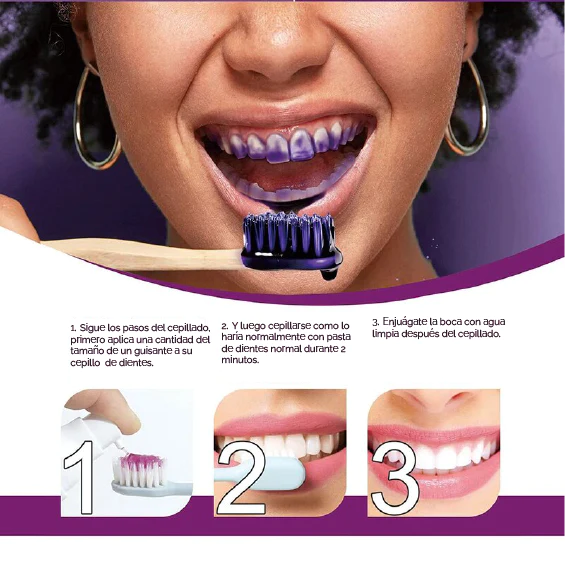 Smile kit - Dentes blancos T